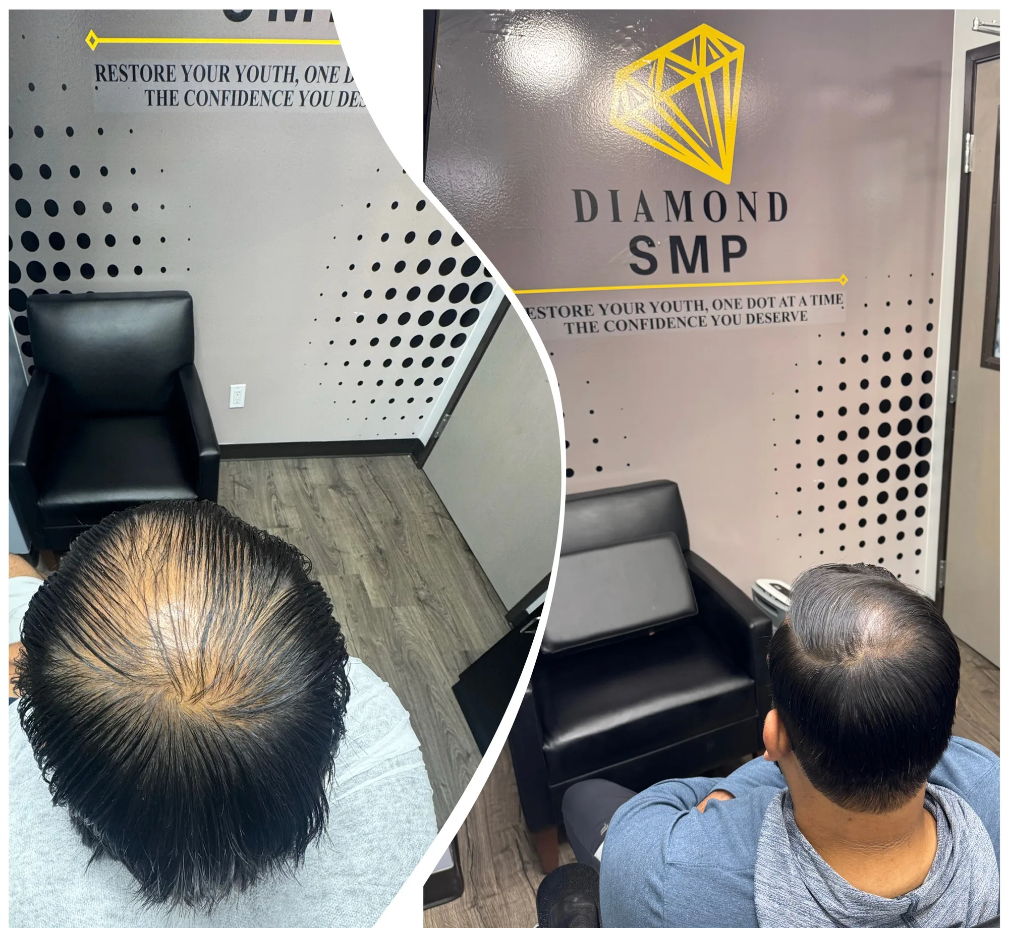 Before and after crown density enhancement from the top