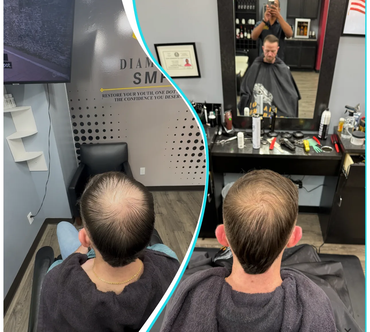 Before and after crown blending result